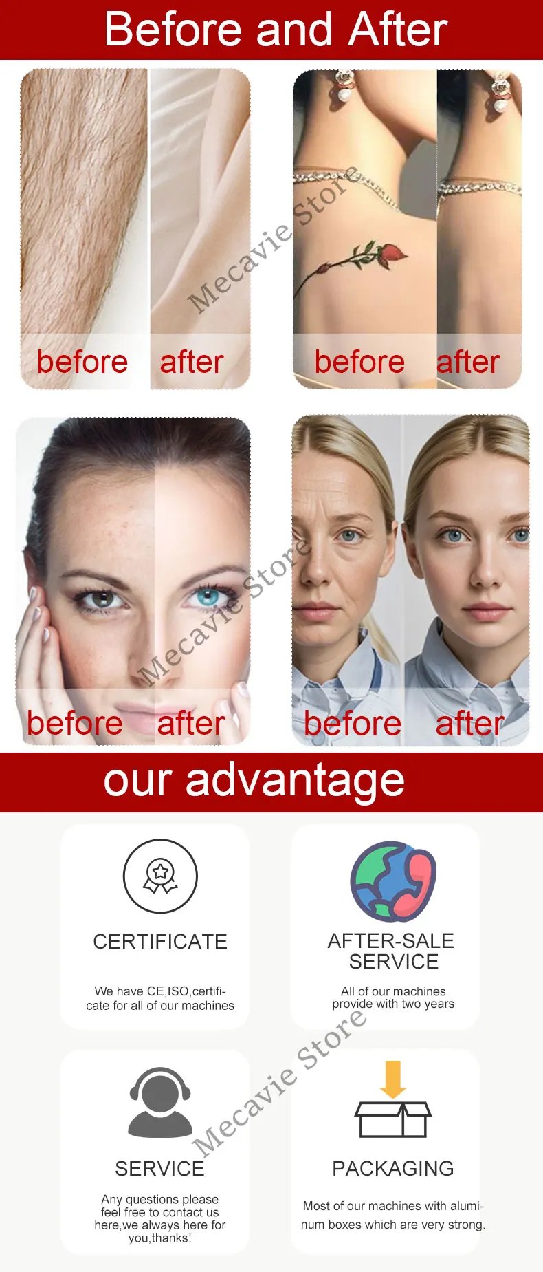 2025 Portable 4IN1 RF IPL OPT Soprano Ice Titanium 808nm Diode Laser Hair Removal Machine Picosecond PICO Tattoo Removal Device